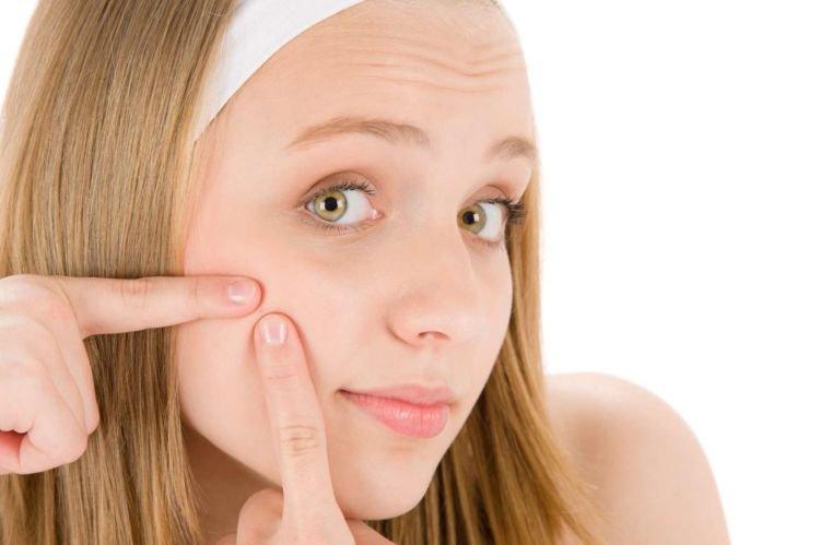Чего нельзя делать - Как избавиться от прыщей на лице