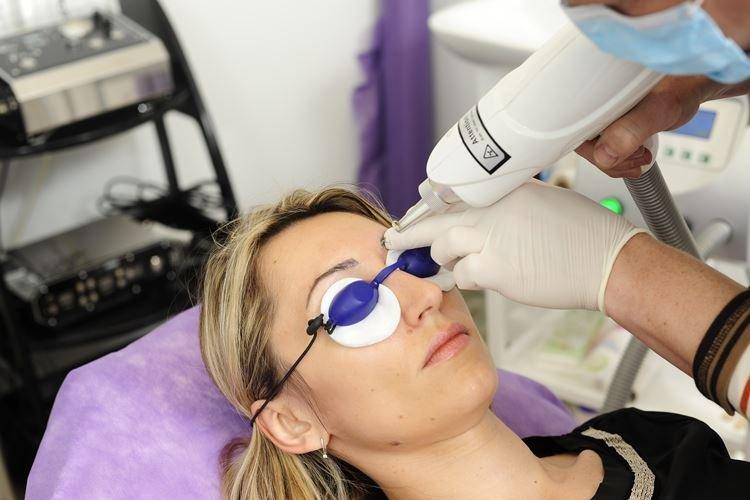 Можно ли удалить перманентный макияж бровей