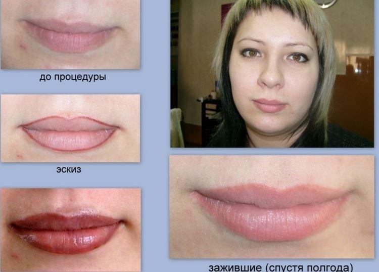 Перманентный макияж губ - фото до и после