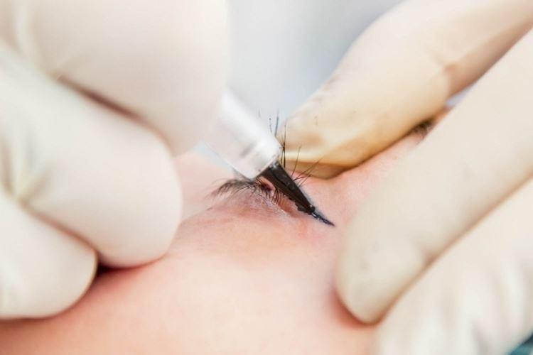 Нужна ли коррекция татуажа глаз