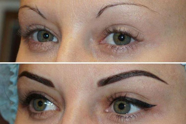 Татуаж глаз - фото до и после